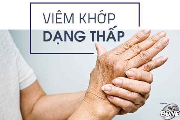 Không tự ý dùng thuốc chữa viêm khớp dạng thấp