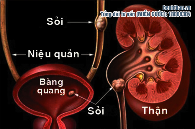 Thận là cơ quan thải độc nhưng dễ bị ảnh hưởng nhất: