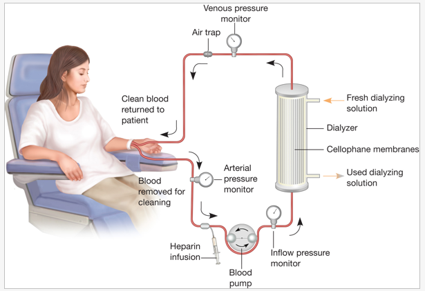 Lọc máu chạy thận nhân tạo