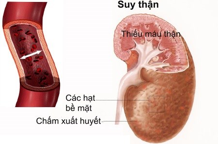 Bài thuốc tăng cường sức khỏe tinh binh