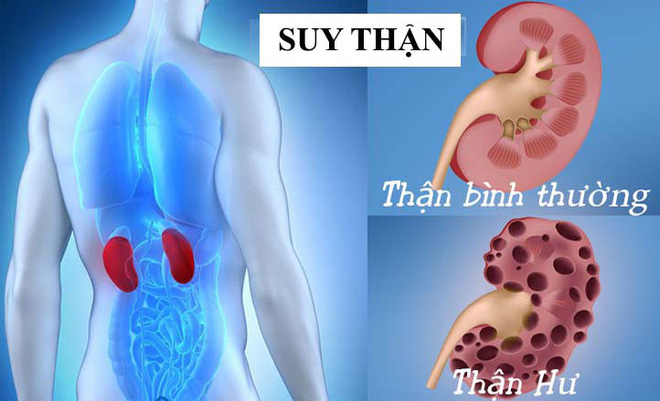 Bệnh thận - căn bệnh gây đau đớn ám ảnh