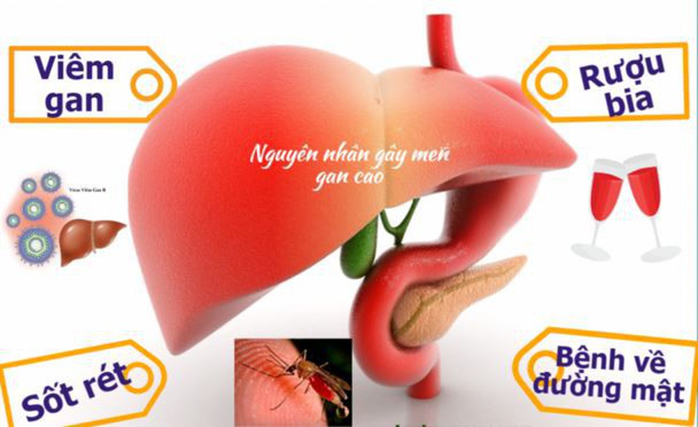 Men gan cao là bệnh gì?