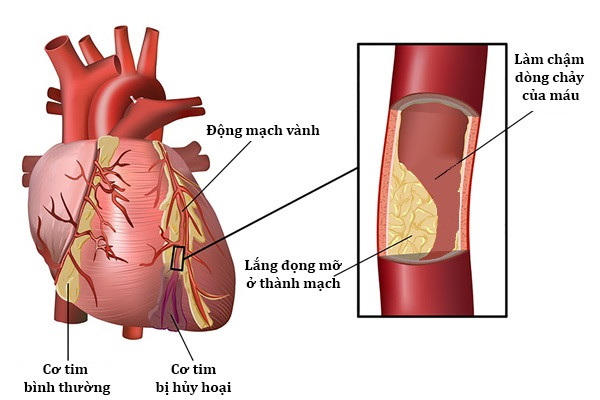 Người bị tăng huyết áp thường dễ mắc phải 7 căn bệnh này không nên chủ quan